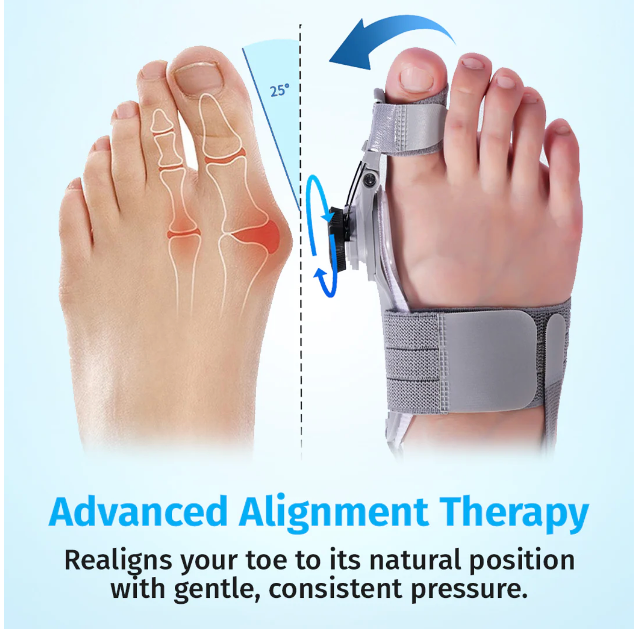 ReAlign Pro™